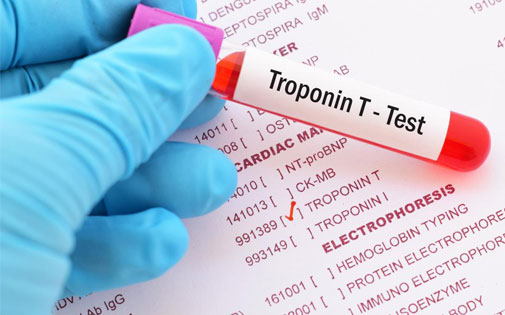 Troponin